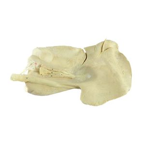 modello anatomico di fegato 1