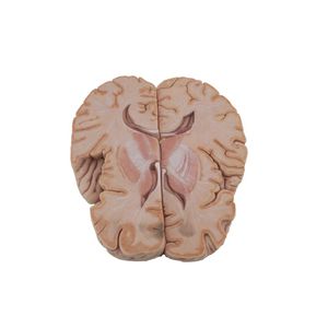 modello anatomico di cervello 1