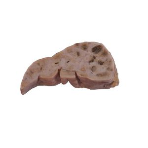 modello anatomico di fegato