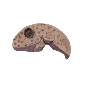 modello anatomico di fegato 1