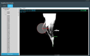 software di visualizzazione DICOM