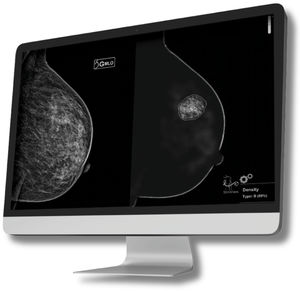 software medicale per tomosintesi mammaria