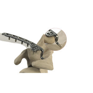 placca di compressione per clavicola
