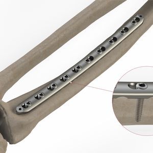 placca di compressione per radio