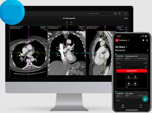 software visualizzatore