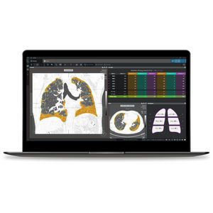 software di analisi 1