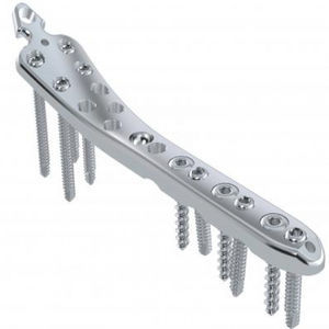 placca di compressione per tibia 1