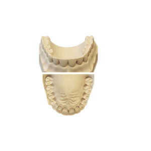materiale odontoiatrico in resina 1
