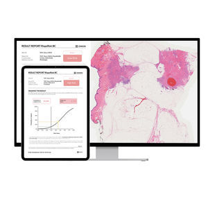 software per screening del tumore al seno