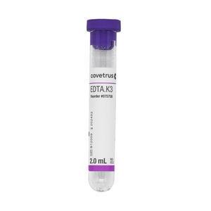 provetta per analisi ematologiche