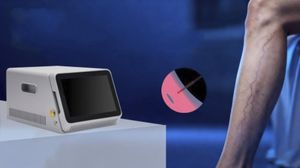laser per trattamento delle varici 1
