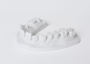 materiale odontoiatrico in pietra