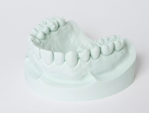 materiale odontoiatrico in gesso