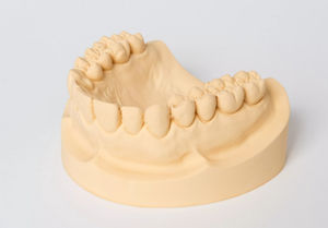 materiale odontoiatrico in gesso