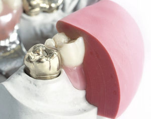 materiale odontoiatrico in silicone