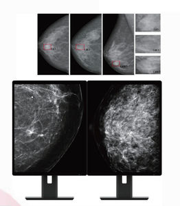 monitor diagnostico