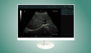 monitor per endoscopia