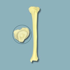 modello anatomico di tibia