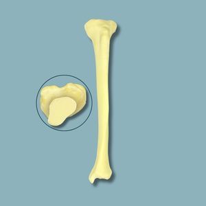 modello anatomico di tibia