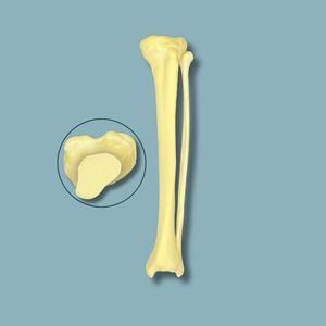 modello anatomico di tibia