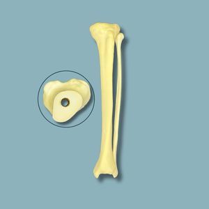 modello anatomico osseo