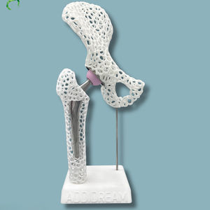 modello anatomico di anca