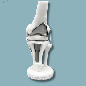 modello anatomico di femore