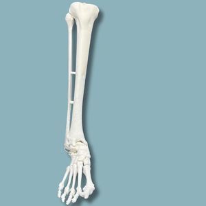 modello anatomico di tibia