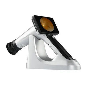 telecamera retinica non-midriatica 1