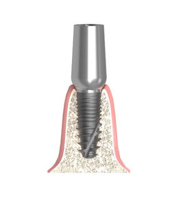 pilastro dentale per impianto cilindrico