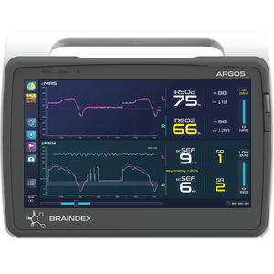 sistema di monitoraggio per EEG