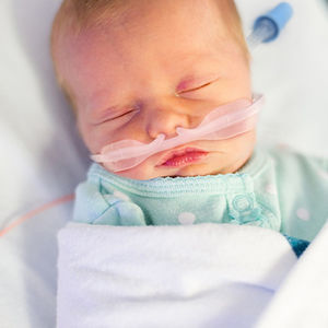cannula nasale a ossigeno 1