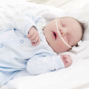 cannula nasale a ossigeno 1