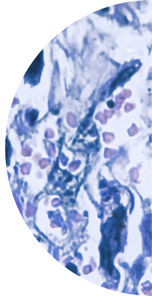 kit di test oncologico