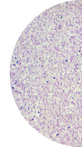 kit di test oncologico