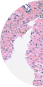 kit di test del cancro della vescica