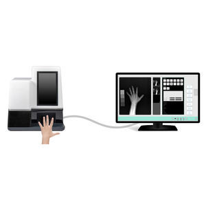 sistema di radiografia