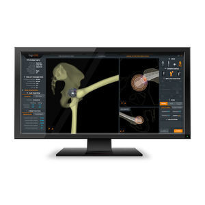 software di analisi 1