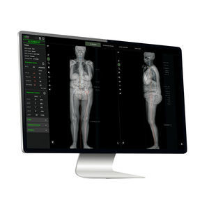 piattaforma AI per il settore medico 1