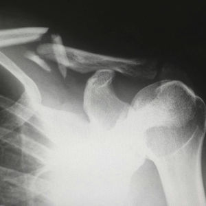 software di analisi delle immagini