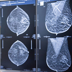 software medicale diagnostico