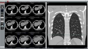 software di visualizzazione DICOM