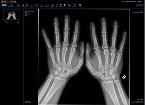 modulo software di visualizzazione DICOM