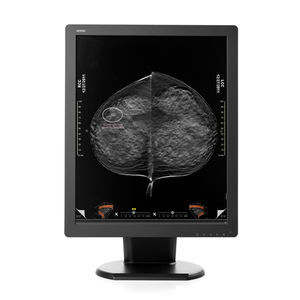 monitor diagnostico