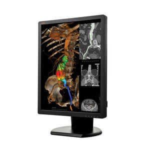 monitor diagnostico 1