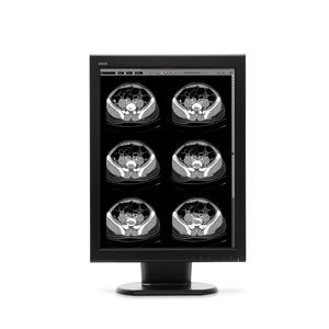 monitor diagnostico 1