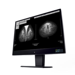 monitor diagnostico