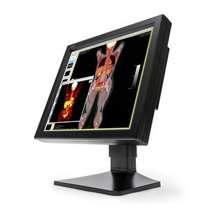 monitor diagnostico 1