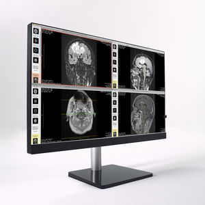 monitor per diagnostica per immagini 1