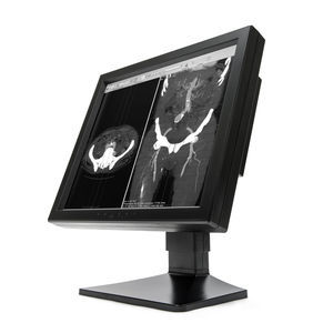 monitor diagnostico